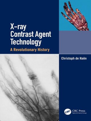 cover image of X-ray Contrast Agent Technology